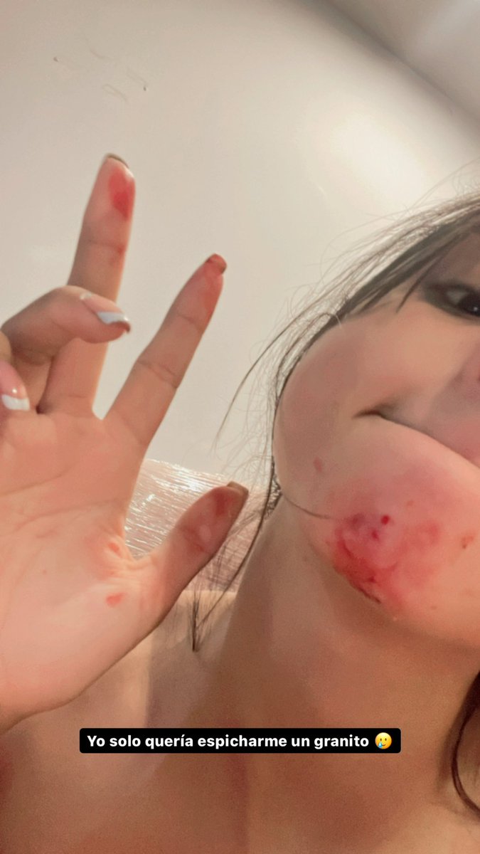 No se espichan granos https://t.co/mLMl1UNFqZ