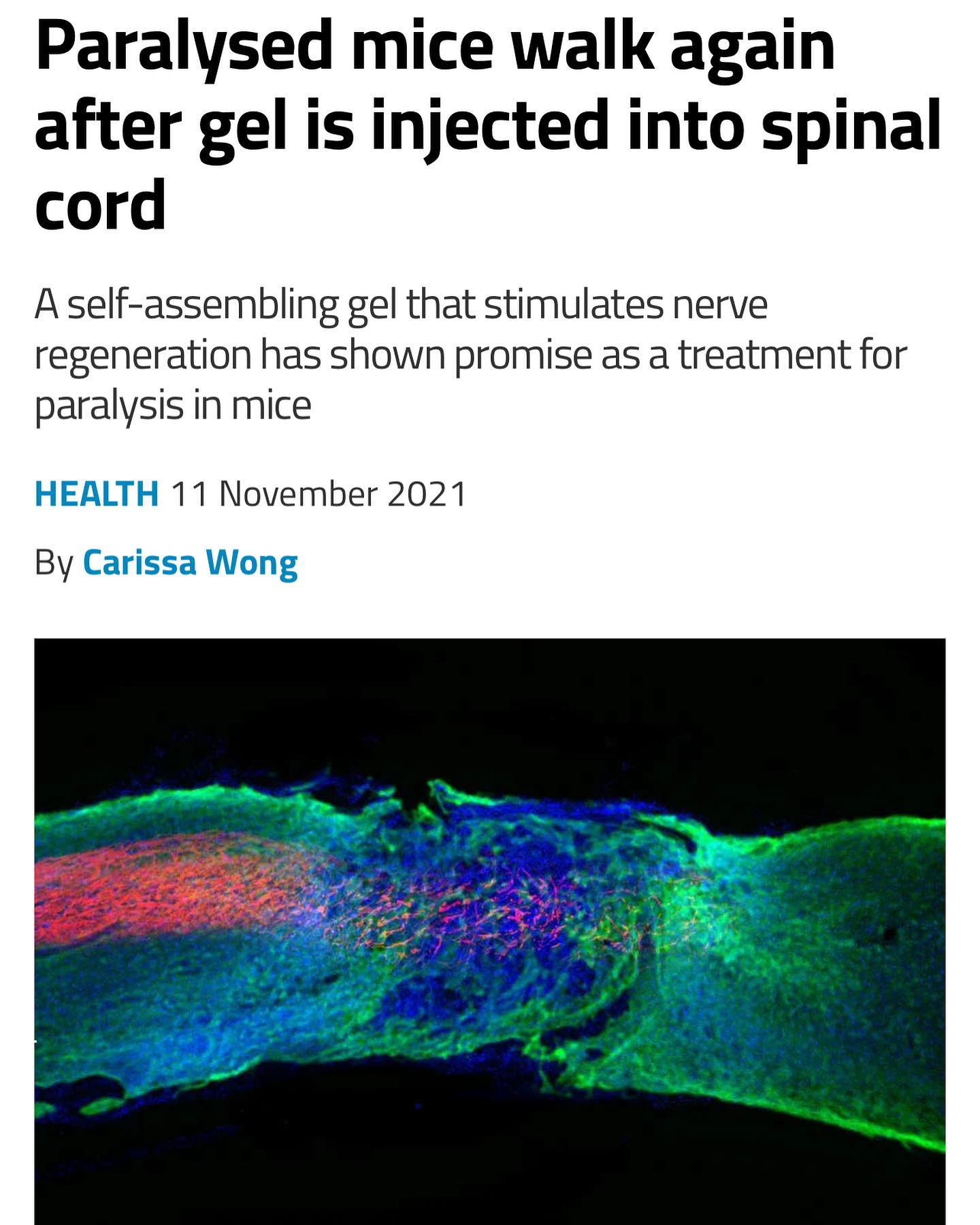 Spinal cord regeneration could one day be a real thing for humans. Limb regeneration is probably going to be a reality one day too. The question is, does it happen before or after they develop synthetic limbs that are superior to biological ones? Artificial Intelligence and the rise of a sentient, completely manufactured, super-intelligent life form are a huge threat to the human race, but I think humans merging with technology and becoming cyborgs might just happen before that.
We all fear change, especially radical, completely transformative change, but it seems pretty likely that this is going to happen. @joerogan