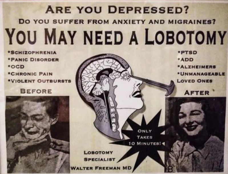 As recently as the 1960’s they were giving people lobotomies, and in 1949 the inventor of the lobotomy was awarded the Nobel prize for it.
More than 50,000 lobotomies were performed in the United States, mostly between 1949 and 1952.  @joerogan