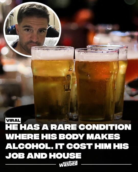 Mark Mongiardo spent years confused and stigmatized by symptoms that mimicked alcoholism—slurred speech, balance issues, and the unmistakable smell of alcohol—despite not drinking. A dedicated teacher and coach, he was repeatedly called into school offices, arrested twice for DWIs, and even faced doubt from his wife, who believed he might be secretly drinking. After searching online, he discovered auto-brewery syndrome, a rare condition where gut microbes convert carbs into alcohol, leading to real intoxication without a single drink. A glucose challenge test confirmed it: his blood alcohol level spiked to 0.14 within an hour of consuming sugar.  By the time he got diagnosed in 2019, Mongiardo had already sold his house and moved in with family—part of the fallout from legal and career consequences. With felony charges pending, he couldn't pass background checks for teaching jobs and struggled to find work, eventually taking a job at Target and later moving to Florida to rebuild as a real estate agent. Now living with a strict no-carb diet and regularly checking his BAC, he hopes his story brings awareness to a condition that nearly derailed his life.