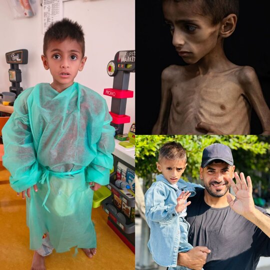Osama Al-Ruqab, a Palestinian child, was critically malnourished, yet the Israeli occupation attempted to deceive the world by attributing his condition to hereditary illnesses rather than starvation.  Following his transfer to Italy, his health has significantly recovered, clearly showing that starvation was the actual cause. 