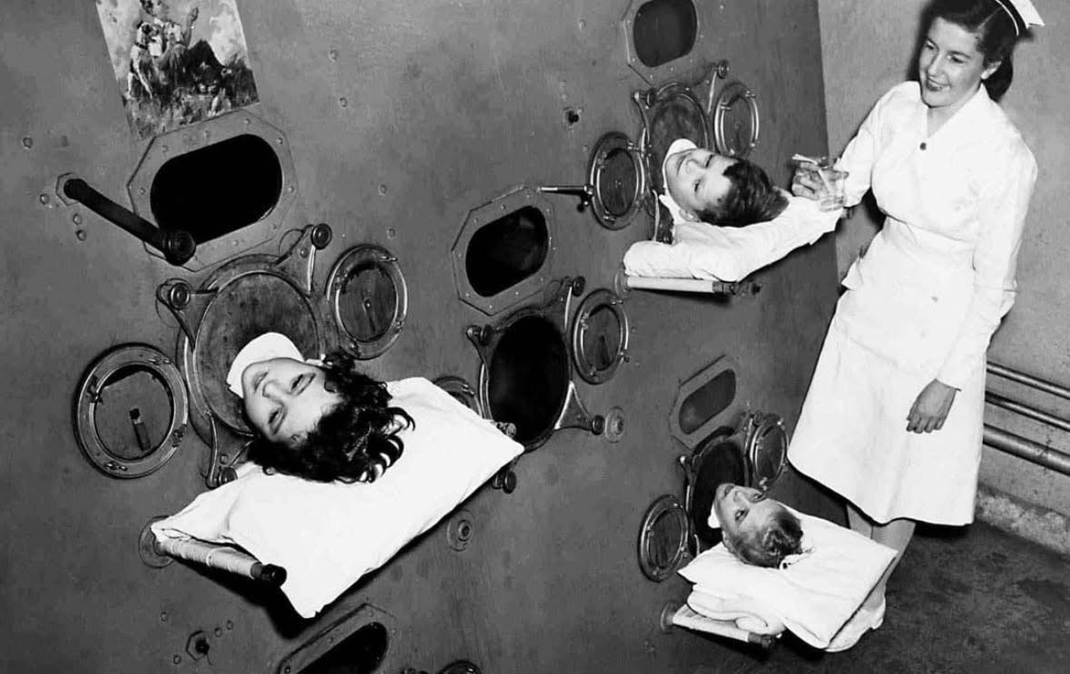 They called it “the coffin you lived in.” Children lay inside for weeks, months—sometimes a lifetime. Heads peeking out. Bodies sealed in steel. A machine breathing for them. It wasn’t a horror movie. It was real. And it wasn’t that long ago. Curious what it looked like? The photos will stop you cold.